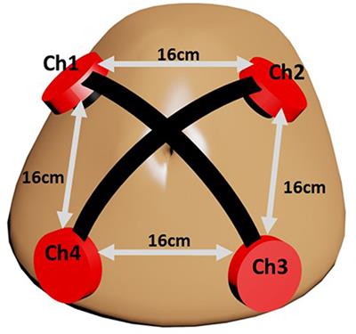 A Comparative Study on Fetal Heart Rates Estimated from Fetal Phonography and Cardiotocography